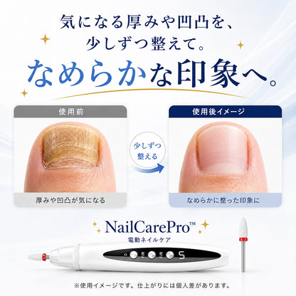 NailCarePro™ - 厚く硬くなった爪をもっと手軽になめらかに