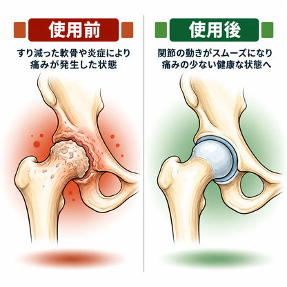 KokanReset™｜温熱・加圧・赤色LEDの3in1股関節ケア